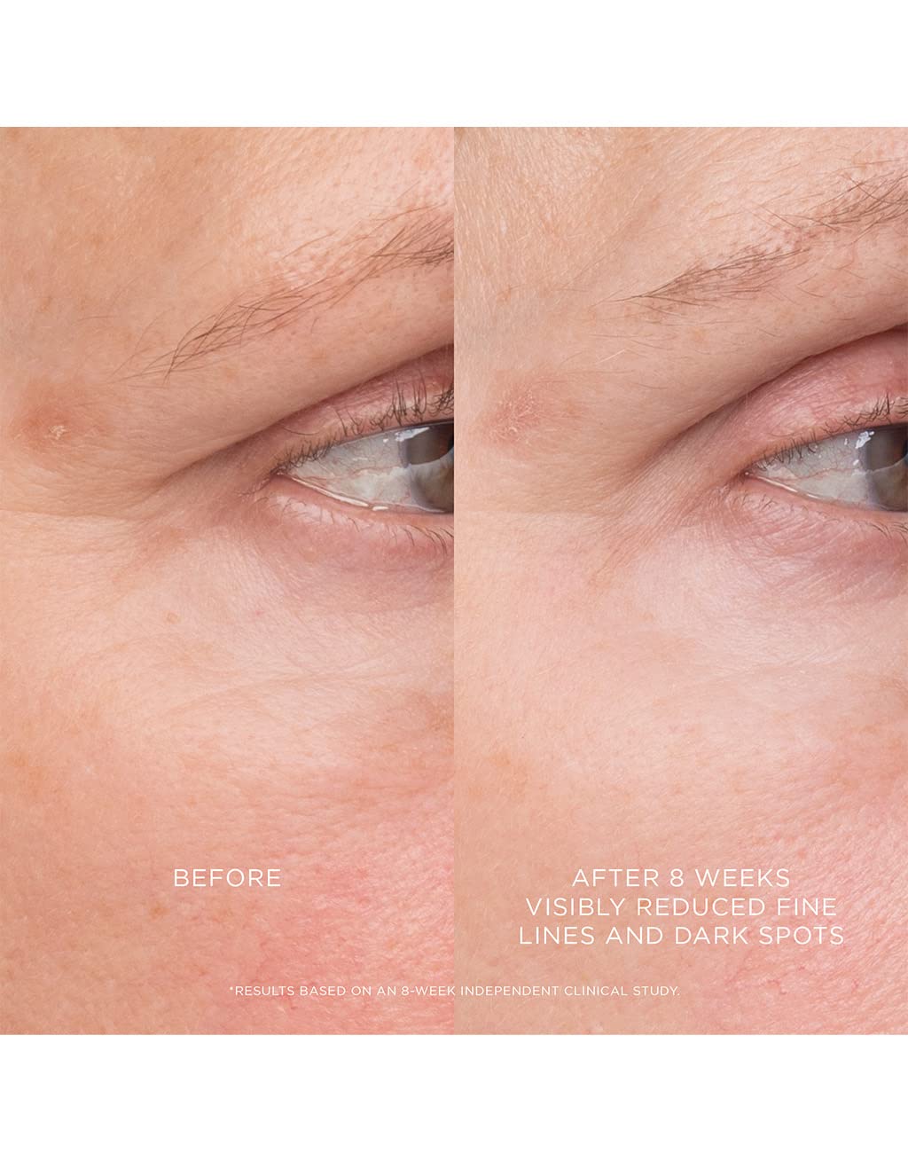 Hourglass Equilibrium Resurfacing Retinoid Treatment - Image 4