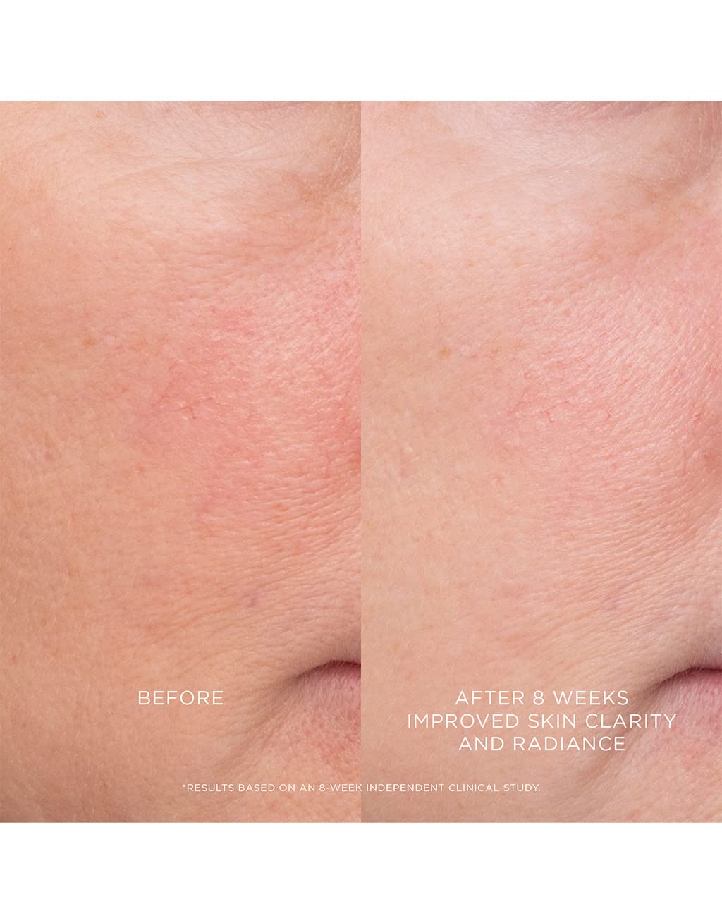 Hourglass Equilibrium Resurfacing Retinoid Treatment - Image 5